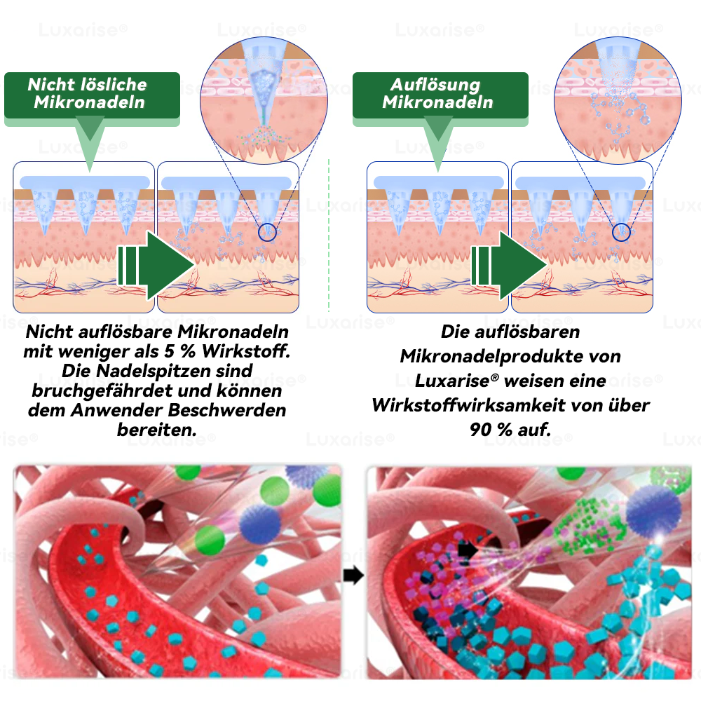 𝐎𝐟𝐟𝐢𝐳𝐢𝐞𝐥𝐥𝐞𝐫 𝐒𝐡𝐨𝐩  | 𝑳𝒖𝒙𝒂𝒓𝒊𝒔𝒆®𝑴𝒐𝒓𝒊𝒏𝒈𝒂 𝒙 𝑩𝒆𝒓𝒃𝒆𝒓𝒊𝒏 10-𝑰𝑵-1 𝒇𝒐𝒓𝒕𝒈𝒆𝒔𝒄𝒉𝒓𝒊𝒕𝒕𝒆𝒏 𝑵𝒂𝒏𝒐 𝑴𝒊𝒌𝒓𝒐𝒏𝒂𝒅𝒆𝒍 𝑷𝒇𝒍𝒂𝒔𝒕𝒆𝒓 (𝑬𝒊𝒏𝒎𝒂𝒍 𝒕ä𝒈𝒍𝒊𝒄𝒉, 𝒔𝒊𝒄𝒉𝒕𝒃𝒂𝒓𝒆 𝑽𝒆𝒓ä𝒏𝒅𝒆𝒓𝒖𝒏𝒈𝒆𝒏 𝒊𝒏 7 𝑻𝒂𝒈𝒆𝒏）✅ 𝑨𝒅𝒊𝒑𝒐𝒔𝒊𝒕𝒂𝒔, 𝑫𝒊𝒂𝒃𝒆𝒕𝒆𝒔, 𝑺𝒄𝒉𝒍𝒂𝒇𝒂𝒑𝒏𝒐𝒆 𝒖𝒏𝒅 𝑮𝒆𝒍𝒆𝒏𝒌𝒑𝒓𝒐𝒃𝒍𝒆𝒎𝒆💯