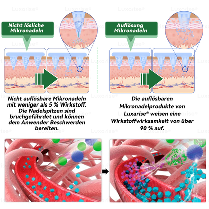 𝐎𝐟𝐟𝐢𝐳𝐢𝐞𝐥𝐥𝐞𝐫 𝐒𝐡𝐨𝐩  | 𝑳𝒖𝒙𝒂𝒓𝒊𝒔𝒆®𝑴𝒐𝒓𝒊𝒏𝒈𝒂 𝒙 𝑩𝒆𝒓𝒃𝒆𝒓𝒊𝒏 10-𝑰𝑵-1 𝒇𝒐𝒓𝒕𝒈𝒆𝒔𝒄𝒉𝒓𝒊𝒕𝒕𝒆𝒏 𝑵𝒂𝒏𝒐 𝑴𝒊𝒌𝒓𝒐𝒏𝒂𝒅𝒆𝒍 𝑷𝒇𝒍𝒂𝒔𝒕𝒆𝒓 (𝑬𝒊𝒏𝒎𝒂𝒍 𝒕ä𝒈𝒍𝒊𝒄𝒉, 𝒔𝒊𝒄𝒉𝒕𝒃𝒂𝒓𝒆 𝑽𝒆𝒓ä𝒏𝒅𝒆𝒓𝒖𝒏𝒈𝒆𝒏 𝒊𝒏 7 𝑻𝒂𝒈𝒆𝒏）✅ 𝑨𝒅𝒊𝒑𝒐𝒔𝒊𝒕𝒂𝒔, 𝑫𝒊𝒂𝒃𝒆𝒕𝒆𝒔, 𝑺𝒄𝒉𝒍𝒂𝒇𝒂𝒑𝒏𝒐𝒆 𝒖𝒏𝒅 𝑮𝒆𝒍𝒆𝒏𝒌𝒑𝒓𝒐𝒃𝒍𝒆𝒎𝒆💯
