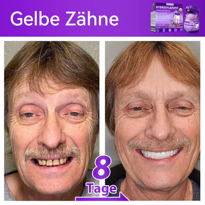 Dormorna®🎁 Herzlichen Glückwunsch! Sie sind einer unserer glücklichen Gewinner! 💪 Als unser exklusiver Glücksstern erhalten Sie jetzt unglaubliche 30% Rabatt! Verpassen Sie nicht diese einmalige Gelegenheit, sich etwas Besonderes zu gönnen!