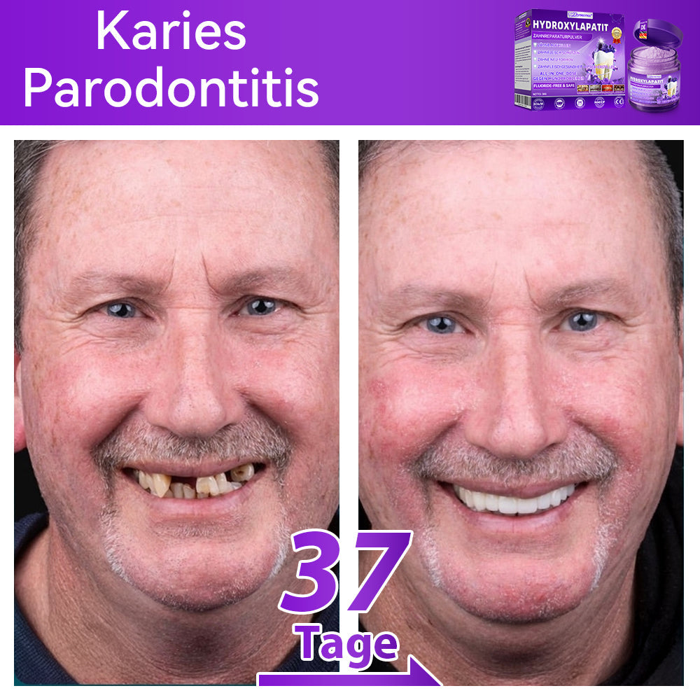 Dormorna®🎁 Herzlichen Glückwunsch! Sie sind einer unserer glücklichen Gewinner! 💪 Als unser exklusiver Glücksstern erhalten Sie jetzt unglaubliche 30% Rabatt! Verpassen Sie nicht diese einmalige Gelegenheit, sich etwas Besonderes zu gönnen!