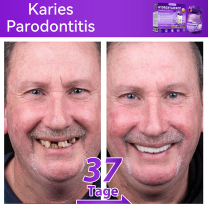 Dormorna®🎁 Herzlichen Glückwunsch! Sie sind einer unserer glücklichen Gewinner! 💪 Als unser exklusiver Glücksstern erhalten Sie jetzt unglaubliche 30% Rabatt! Verpassen Sie nicht diese einmalige Gelegenheit, sich etwas Besonderes zu gönnen!