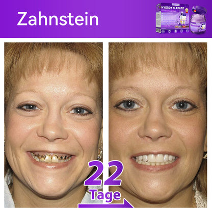 Dormorna®🎁 Herzlichen Glückwunsch! Sie sind einer unserer glücklichen Gewinner! 💪 Als unser exklusiver Glücksstern erhalten Sie jetzt unglaubliche 30% Rabatt! Verpassen Sie nicht diese einmalige Gelegenheit, sich etwas Besonderes zu gönnen!