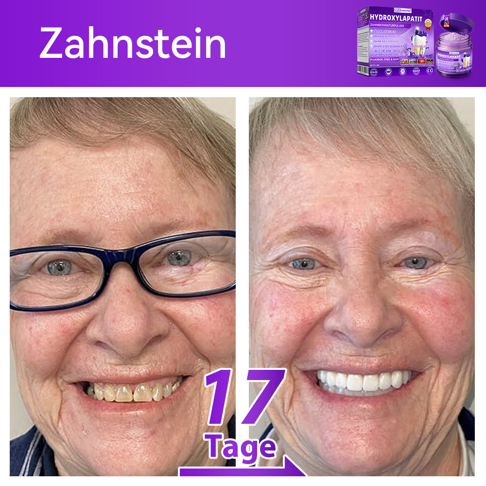 Dormorna®🎁 Herzlichen Glückwunsch! Sie sind einer unserer glücklichen Gewinner! 💪 Als unser exklusiver Glücksstern erhalten Sie jetzt unglaubliche 30% Rabatt! Verpassen Sie nicht diese einmalige Gelegenheit, sich etwas Besonderes zu gönnen!