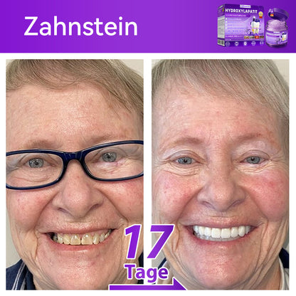 Dormorna®🎁 Herzlichen Glückwunsch! Sie sind einer unserer glücklichen Gewinner! 💪 Als unser exklusiver Glücksstern erhalten Sie jetzt unglaubliche 30% Rabatt! Verpassen Sie nicht diese einmalige Gelegenheit, sich etwas Besonderes zu gönnen!